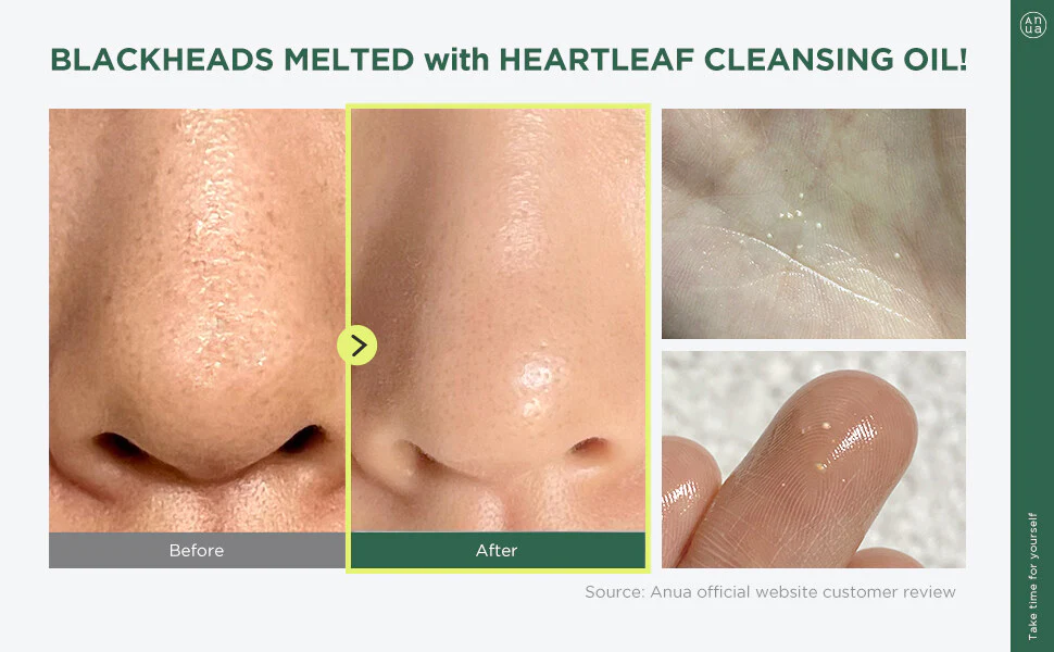 Heartleaf Pore Control Cleanser Oil (200 ml)